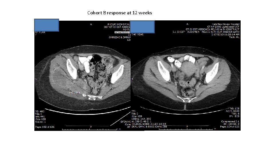 Cohort 8 response at 12 weeks 