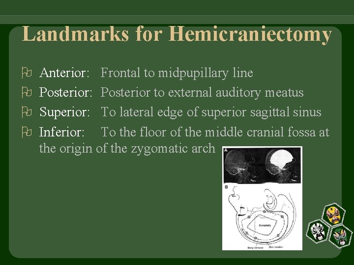 Landmarks for Hemicraniectomy Anterior: Frontal to midpupillary line Posterior: Posterior to external auditory meatus