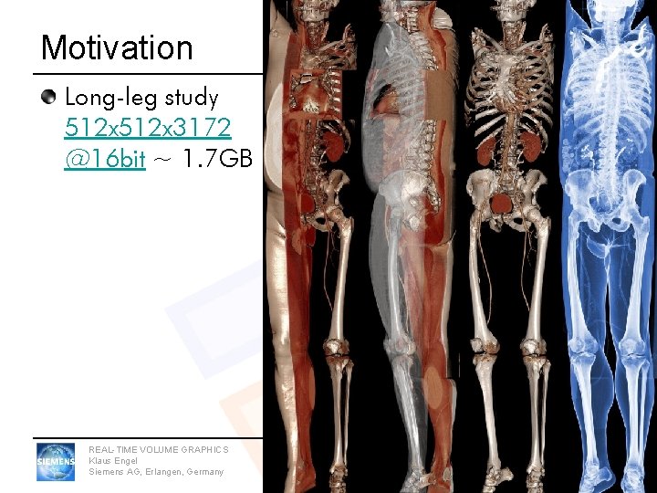 Motivation Long-leg study 512 x 3172 @16 bit ~ 1. 7 GB REAL-TIME VOLUME