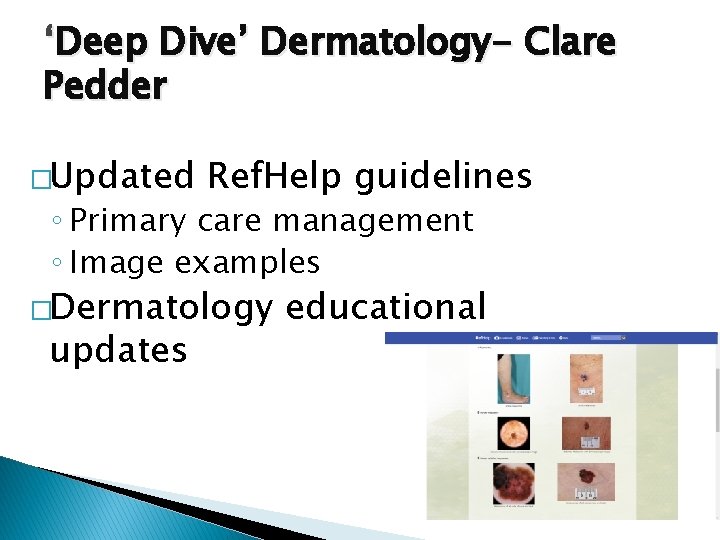 ‘Deep Dive’ Dermatology- Clare Pedder �Updated Ref. Help guidelines ◦ Primary care management ◦ ‘Deep Dive’ Dermatology- Clare Pedder �Updated Ref. Help guidelines ◦ Primary care management ◦