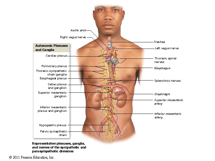 Aortic arch Right vagus nerve Trachea Autonomic Plexuses and Ganglia Cardiac plexus Pulmonary plexus