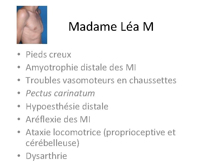 Madame Léa M Pieds creux Amyotrophie distale des MI Troubles vasomoteurs en chaussettes Pectus Madame Léa M Pieds creux Amyotrophie distale des MI Troubles vasomoteurs en chaussettes Pectus