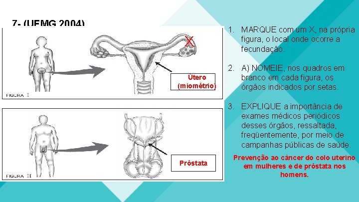 7 - (UFMG 2004) X Útero (miométrio) 1. MARQUE com um X, na própria 7 - (UFMG 2004) X Útero (miométrio) 1. MARQUE com um X, na própria