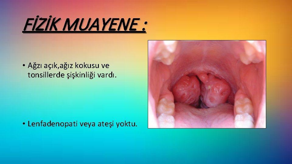 FİZİK MUAYENE : • Ağzı açık, ağız kokusu ve tonsillerde şişkinliği vardı. • Lenfadenopati