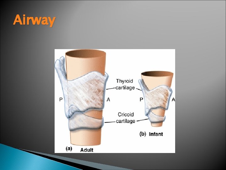 Airway 