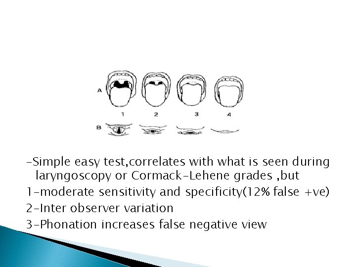 -Simple easy test, correlates with what is seen during laryngoscopy or Cormack-Lehene grades ,