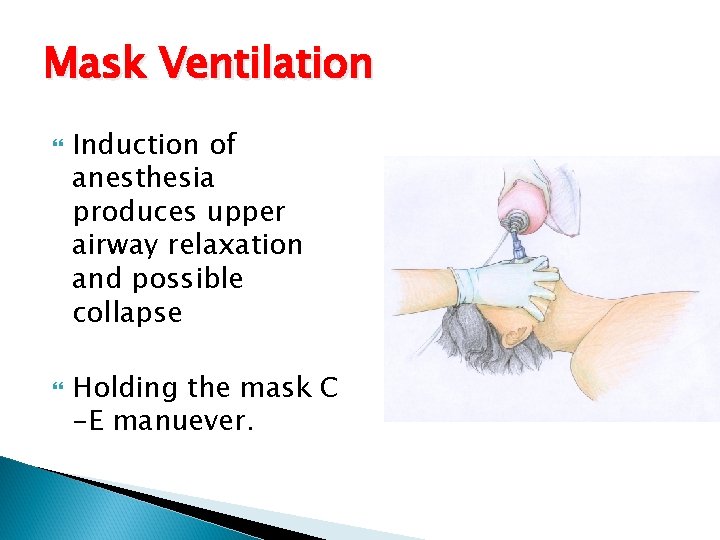 Mask Ventilation Induction of anesthesia produces upper airway relaxation and possible collapse Holding the