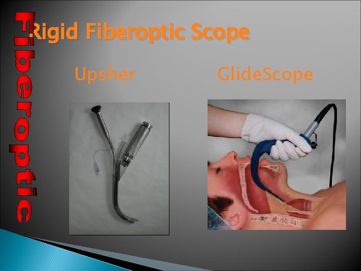 Rigid Fiberoptic Scope Upsher Glide. Scope 