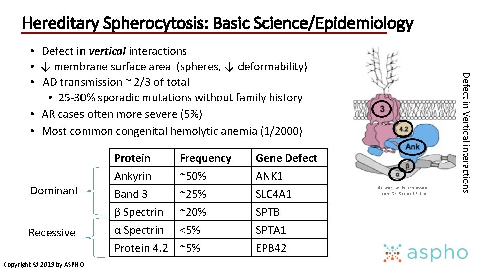 Hereditary Spherocytosis: Basic Science/Epidemiology Dominant Recessive Copyright © 2019 by ASPHO Protein Ankyrin Band