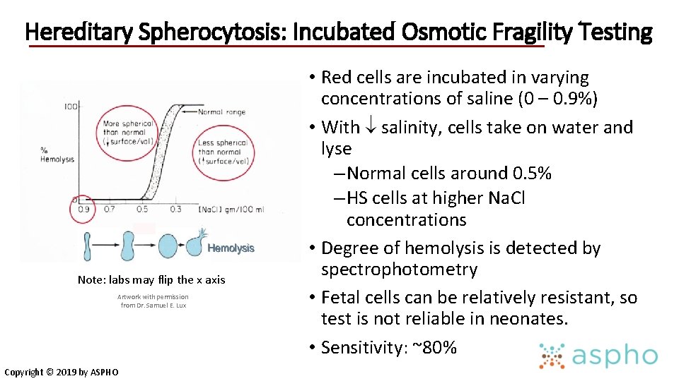 Hereditary Spherocytosis: Incubated Osmotic Fragility Testing Note: labs may flip the x axis Artwork