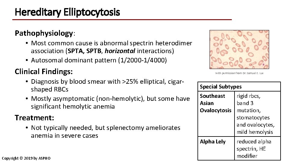 Hereditary Elliptocytosis Pathophysiology: • Most common cause is abnormal spectrin heterodimer association (SPTA, SPTB,