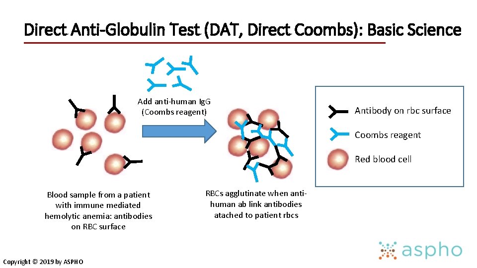Direct Anti-Globulin Test (DAT, Direct Coombs): Basic Science Add anti-human Ig. G (Coombs reagent)