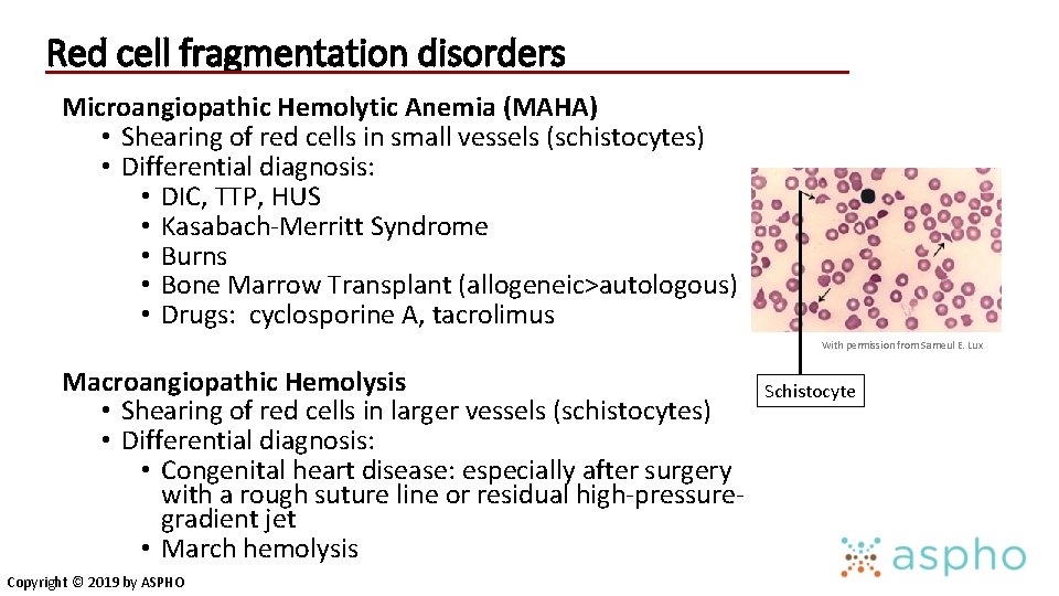 Red cell fragmentation disorders Microangiopathic Hemolytic Anemia (MAHA) • Shearing of red cells in