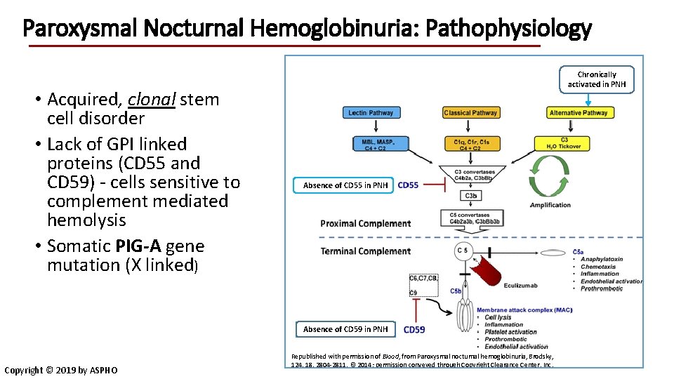 Paroxysmal Nocturnal Hemoglobinuria: Pathophysiology • Acquired, clonal stem cell disorder • Lack of GPI