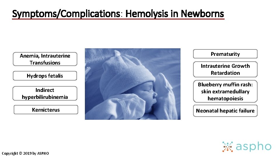 Symptoms/Complications: Hemolysis in Newborns Anemia, Intrauterine Transfusions Prematurity Hydrops fetalis Intrauterine Growth Retardation Indirect