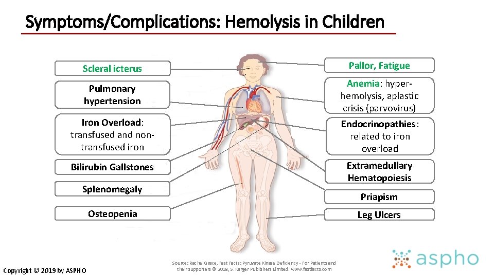 Symptoms/Complications: Hemolysis in Children Scleral icterus Pallor, Fatigue Pulmonary hypertension Anemia: hyperhemolysis, aplastic crisis