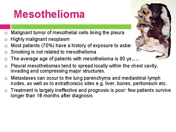 Mesothelioma Malignant tumor of mesothelial cells lining the pleura Highly malignant neoplasm Most patients
