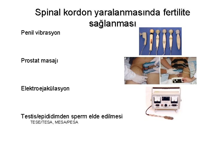 Spinal kordon yaralanmasında fertilite sağlanması Penil vibrasyon Prostat masajı Elektroejakülasyon Testis/epididimden sperm elde edilmesi