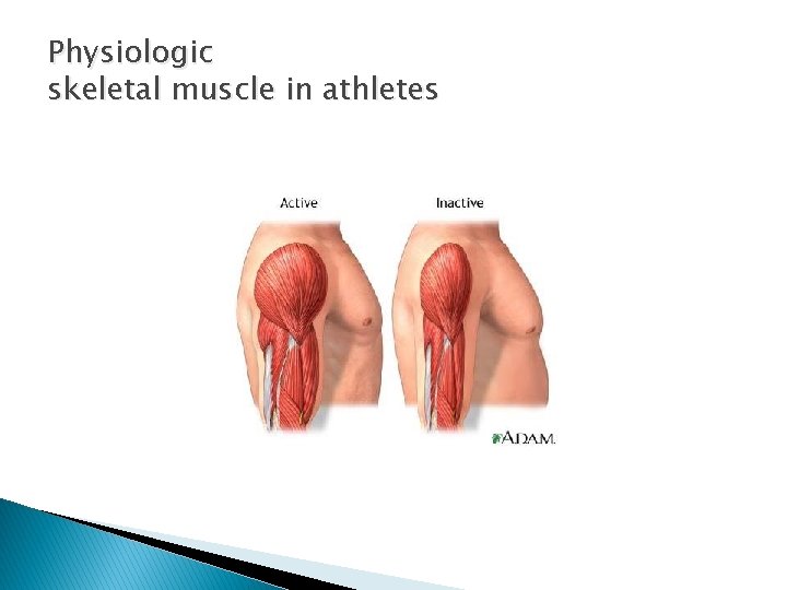 Physiologic skeletal muscle in athletes 