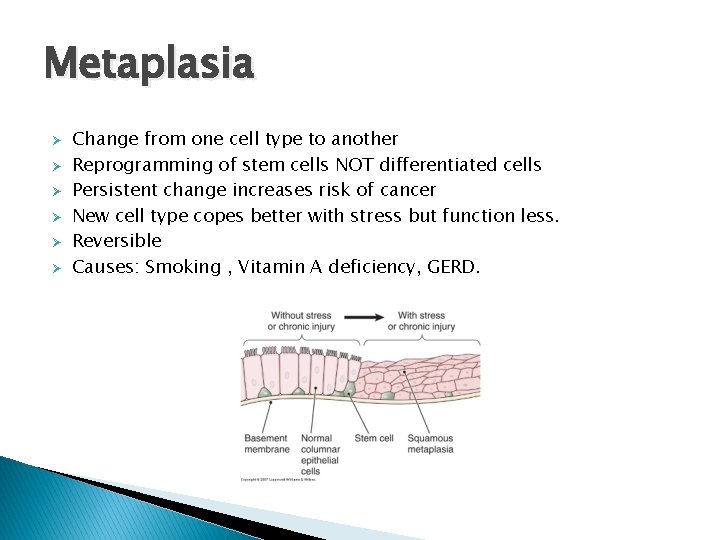 Metaplasia Ø Ø Ø Change from one cell type to another Reprogramming of stem