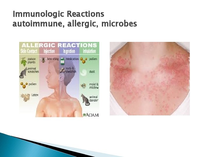 Immunologic Reactions autoimmune, allergic, microbes 