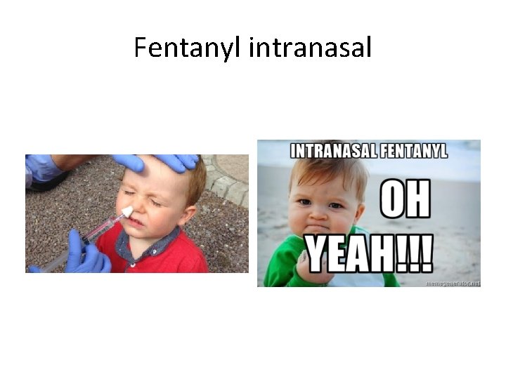 Fentanyl intranasal 