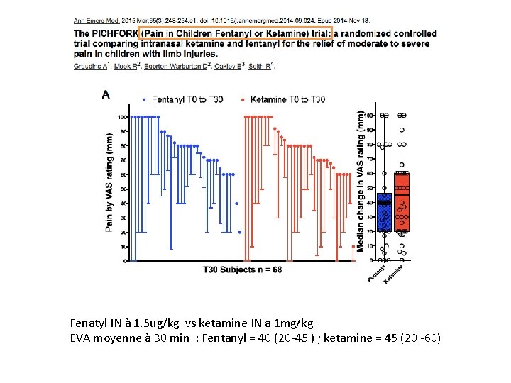 Fenatyl IN à 1. 5 ug/kg vs ketamine IN a 1 mg/kg EVA moyenne