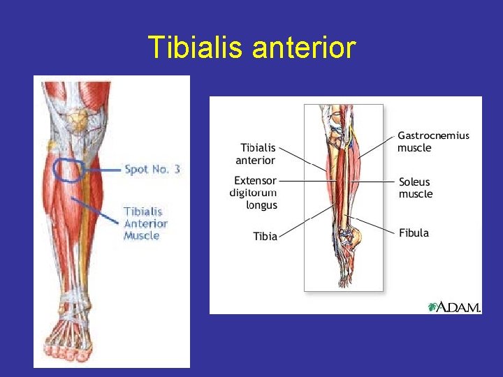 Tibialis anterior 