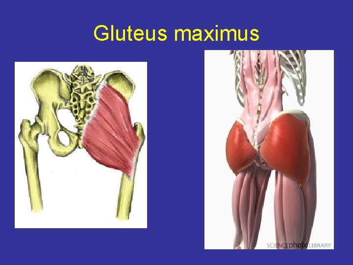 Gluteus maximus 