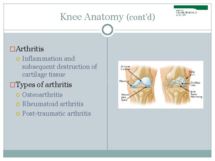 Knee Anatomy (cont’d) �Arthritis Inflammation and subsequent destruction of cartilage tissue �Types of arthritis