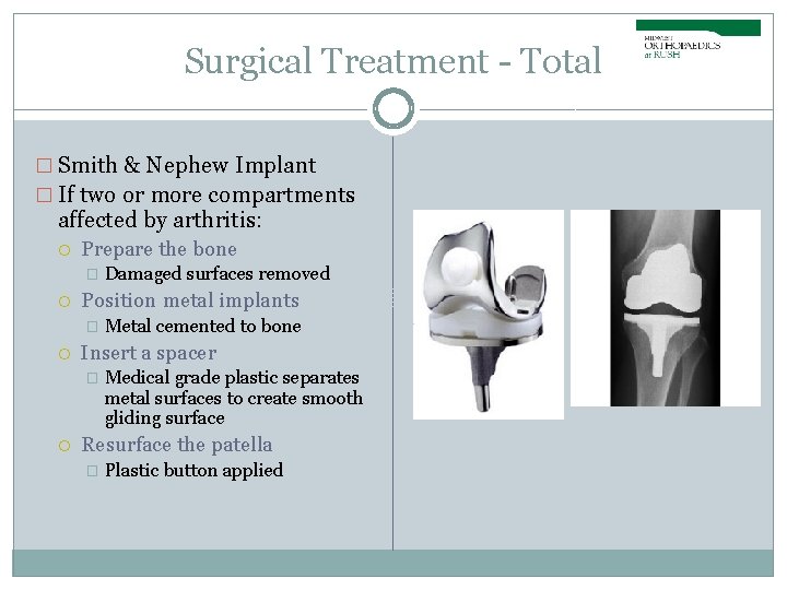Surgical Treatment - Total � Smith & Nephew Implant � If two or more