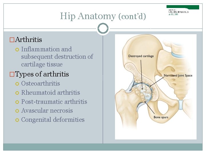 Hip Anatomy (cont’d) �Arthritis Inflammation and subsequent destruction of cartilage tissue �Types of arthritis