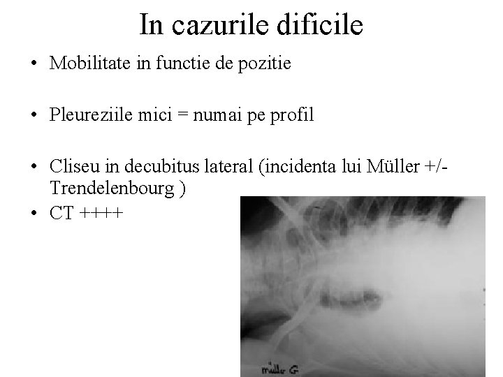 In cazurile dificile • Mobilitate in functie de pozitie • Pleureziile mici = numai
