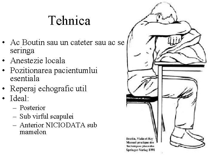 Tehnica • Ac Boutin sau un cateter sau ac se seringa • Anestezie locala