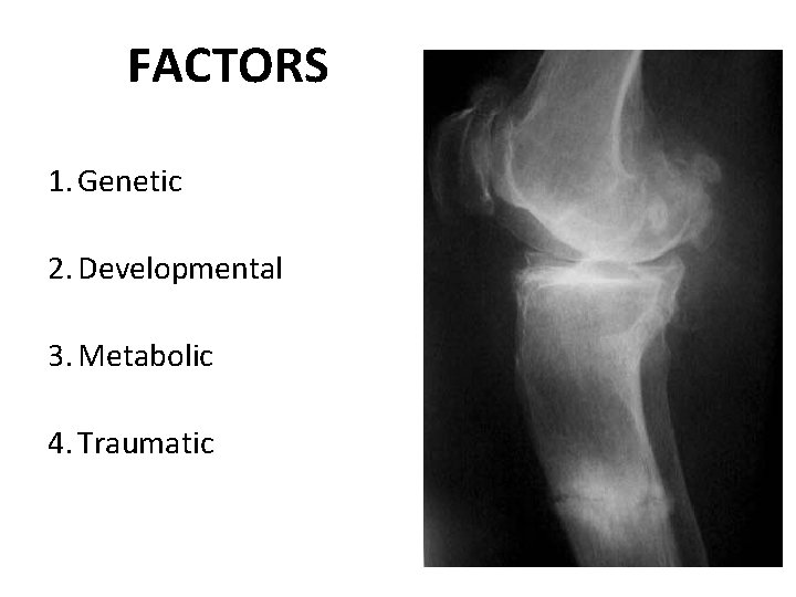 FACTORS 1. Genetic 2. Developmental 3. Metabolic 4. Traumatic 