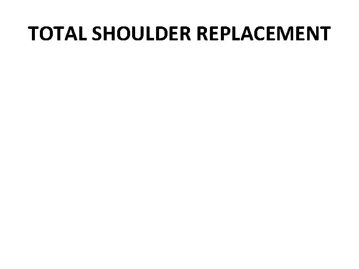 TOTAL SHOULDER REPLACEMENT 