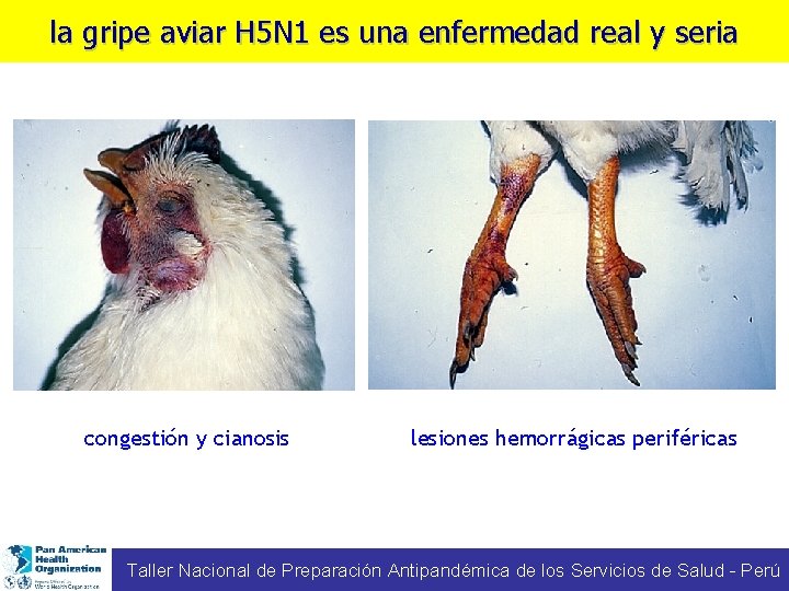 la gripe aviar H 5 N 1 es una enfermedad real y seria congestión