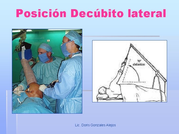 Posición Decúbito lateral Lic. Doris Gonzales Alejos 