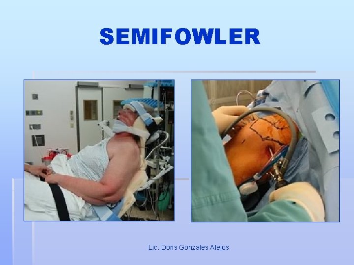 SEMIFOWLER Lic. Doris Gonzales Alejos 