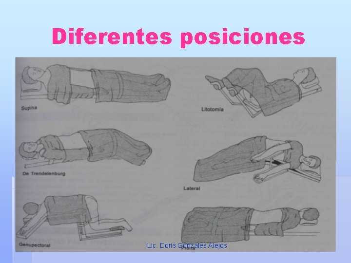 Diferentes posiciones Lic. Doris Gonzales Alejos 