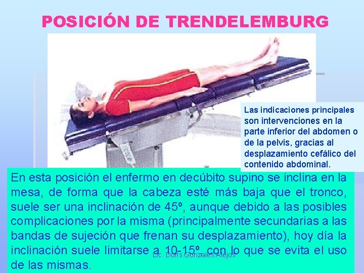 POSICIÓN DE TRENDELEMBURG Las indicaciones principales son intervenciones en la parte inferior del abdomen