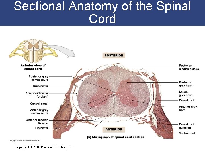 Sectional Anatomy of the Spinal Cord Copyright © 2010 Pearson Education, Inc. 