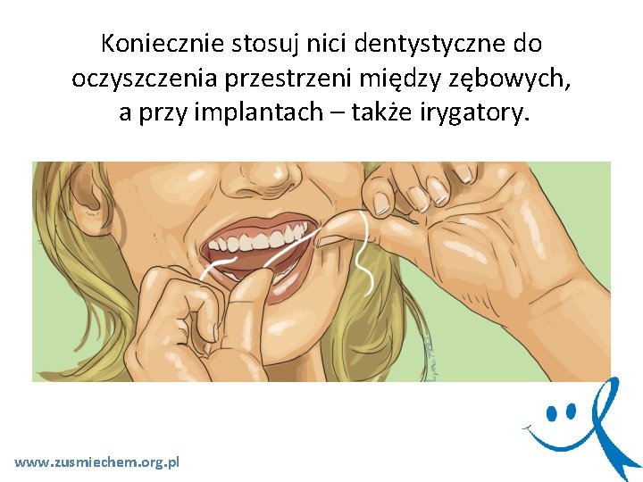 Koniecznie stosuj nici dentystyczne do oczyszczenia przestrzeni między zębowych, a przy implantach – także