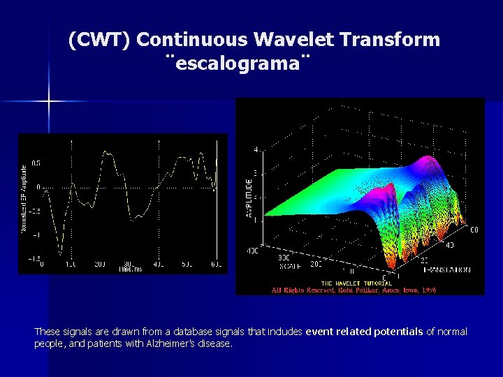 (CWT) Continuous Wavelet Transform ¨escalograma¨ These signals are drawn from a database signals that