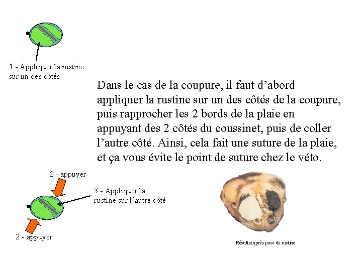 1 - Appliquer la rustine sur un des côtés Dans le cas de la