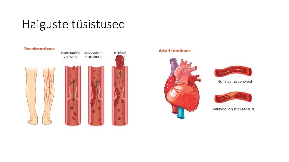 Haiguste tüsistused 