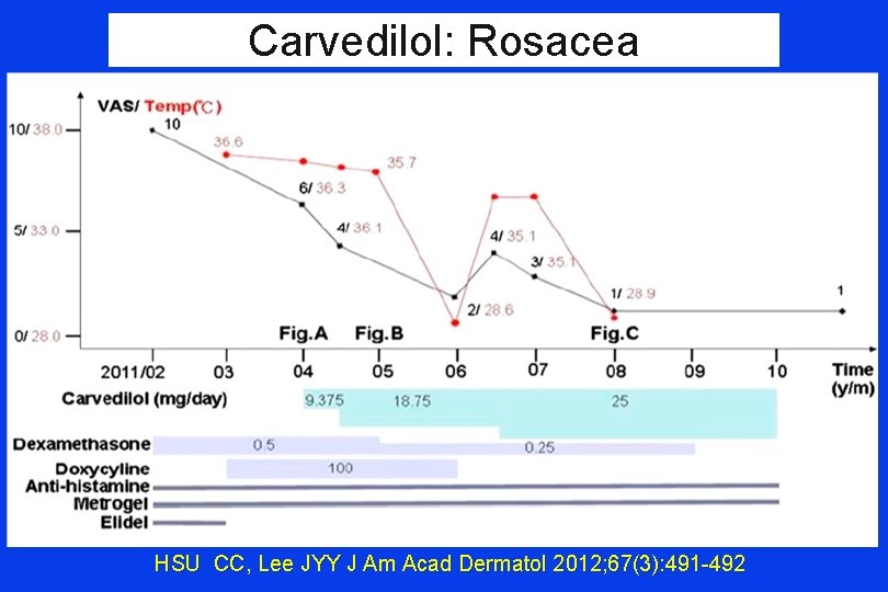 Carvedilol: Rosacea HSU CC, Lee JYY J Am Acad Dermatol 2012; 67(3): 491 -492