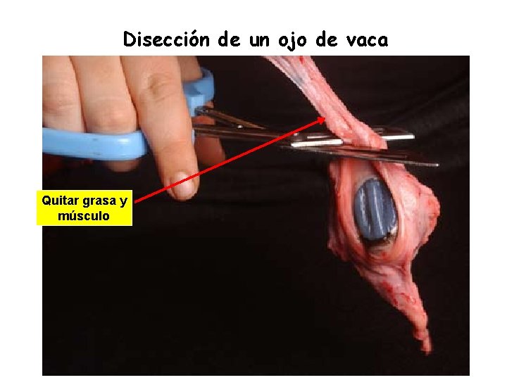 Disección de un ojo de vaca Quitar grasa y músculo 