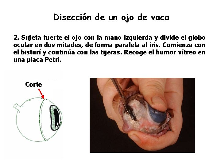 Disección de un ojo de vaca 2. Sujeta fuerte el ojo con la mano