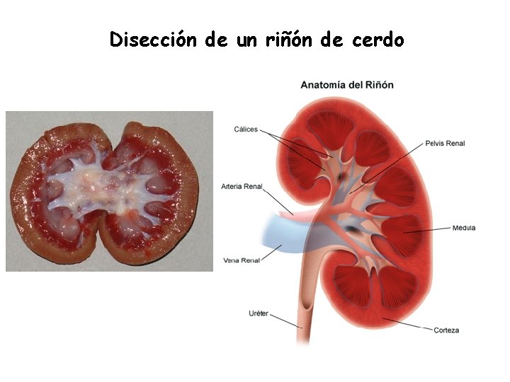 Disección de un riñón de cerdo 